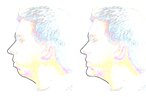 Proportional chin