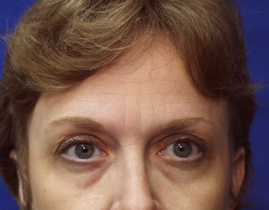 The Aging Process